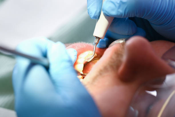 Best Emergency Gum Pain Relief  in Montgomery, OH